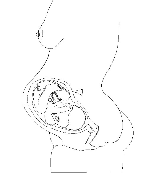 Fetob
